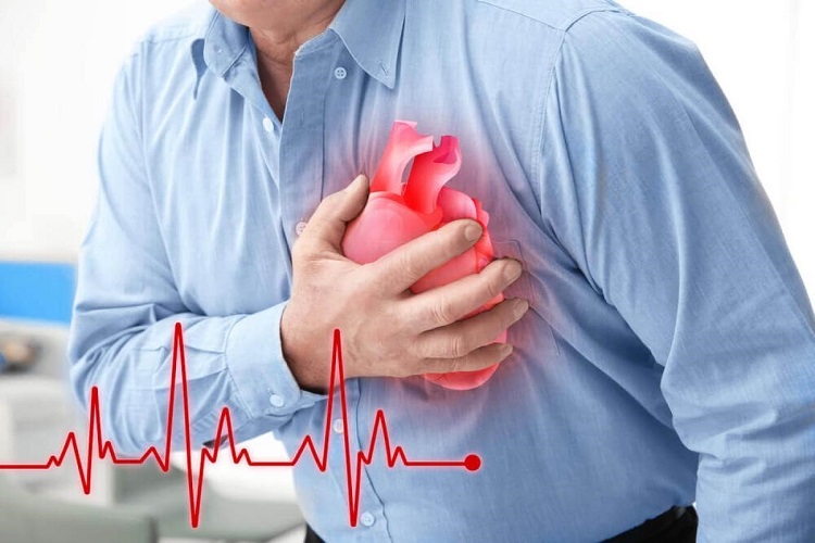 Triệu chứng của rối loạn nhịp tim-2