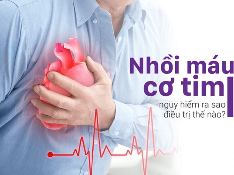 Cách sơ cứu nhồi máu cơ tim giúp người bệnh thoát khỏi nguy hiểm