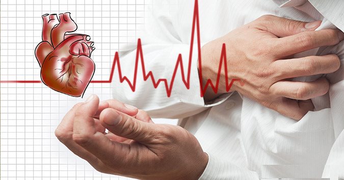 Nhồi máu cơ tim – Một biến chứng nguy hiểm