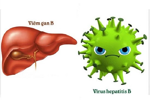 Virus viêm gan B có khả năng lây nhiễm cao gấp 50-100 lần so với HIV
