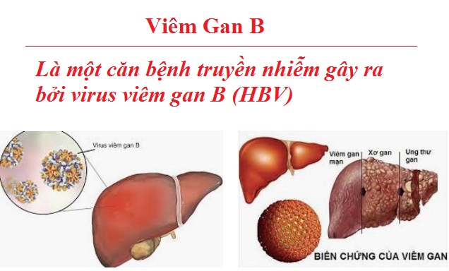  [Cảnh báo] tỷ lệ viêm gan B ở Việt Nam đang ở mức cao