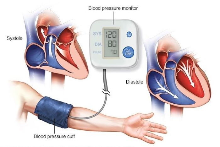 Chế độ ăn phòng ngừa biến chứng cho bệnh nhân tăng huyết áp